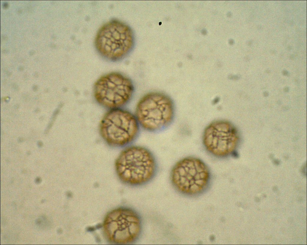 Comatricha o Stemonitopsis?